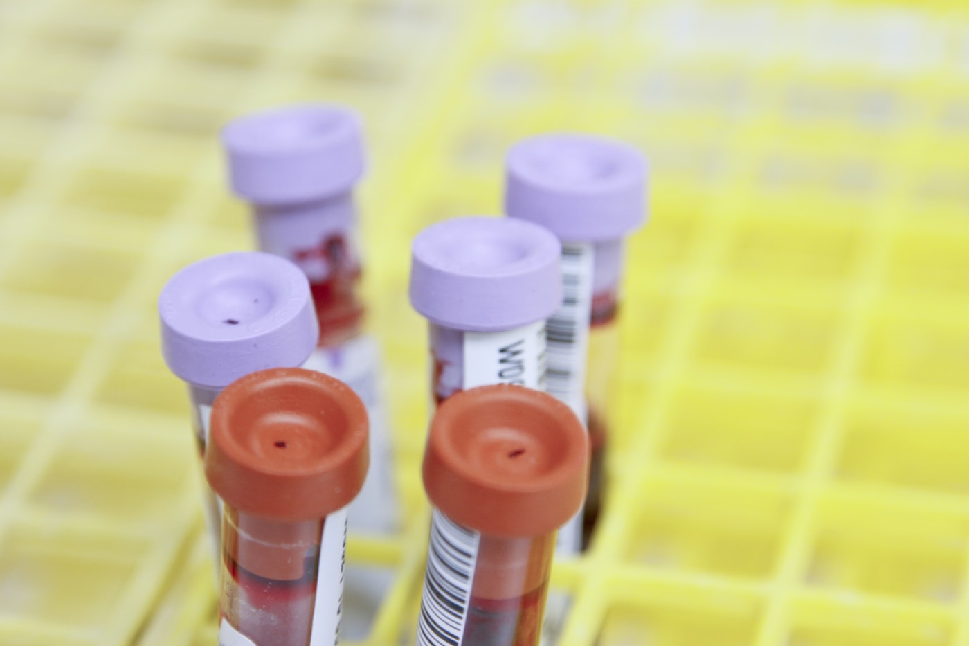 Hospital lab and blood bank support
